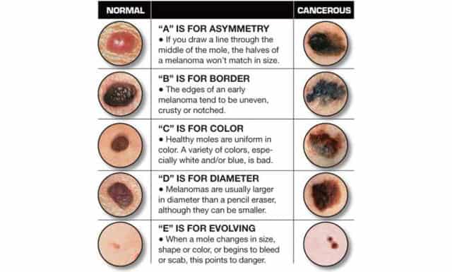 ABC of moles